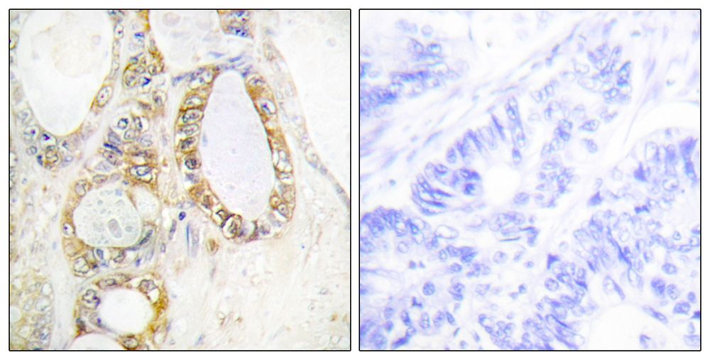 IHC