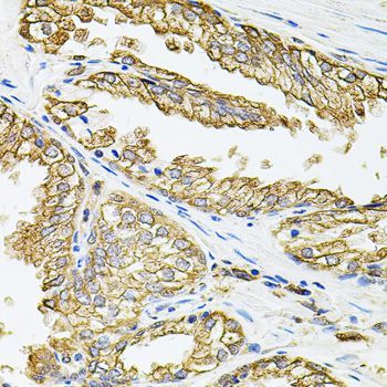 Immunohistochemistry - HLA-DQA1 antibody (144-02168)
