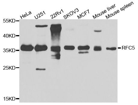 Western blot - RFC5 Polyclonal Antibody (144-08056)