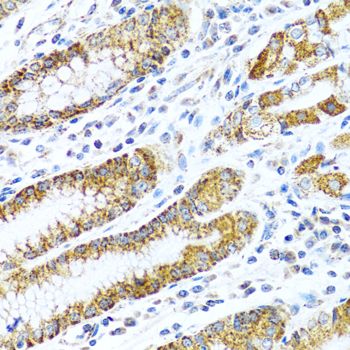 Immunohistochemistry - LRPPRC antibody (144-03365)