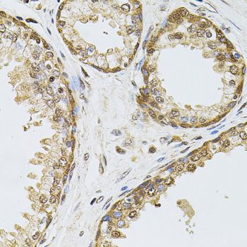 Immunohistochemistry - POP4 antibody (144-04452)