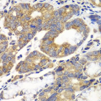 Immunohistochemistry - PFKM antibody (144-05477)