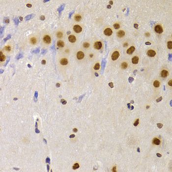 Immunohistochemistry - HNRNPA1 Polyclonal Antibody (144-07491)