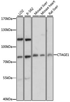 Western blot - CTAGE1 antibody (144-60245)