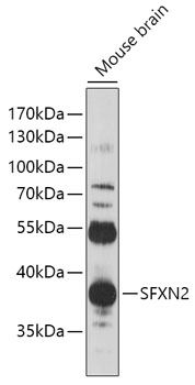 Western blot