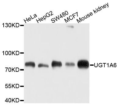 Western blot - UGT1A6 Polyclonal Antibody (144-10033)