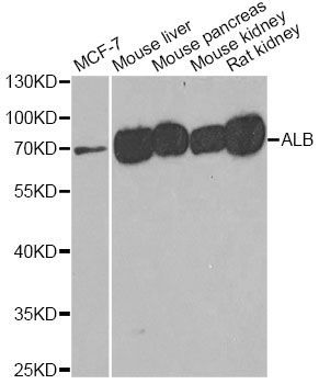 Western blot - ALB Polyclonal Antibody (144-01363)