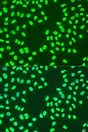 Immunohistochemistry - [KO Validated] CBX3 Polyclonal Antibody (144-02248)