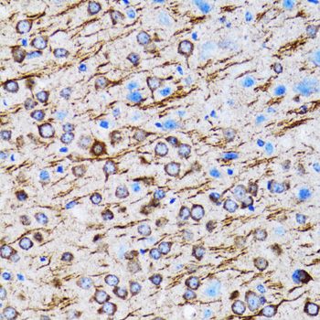 Immunohistochemistry - MAP1LC3A antibody (144-011438)
