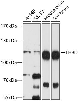 Western blot