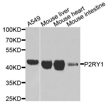 Western blot - P2RY1 Polyclonal Antibody (144-07706)