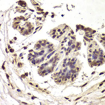 Immunohistochemistry - INTS6 Antibody (144-06634)