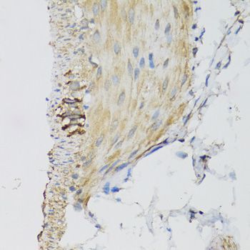 Immunohistochemistry - DGUOK antibody (144-06898)
