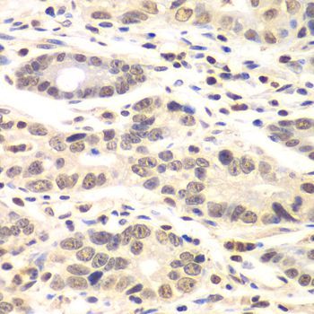 Immunohistochemistry - CCNC Polyclonal Antibody (144-06545)