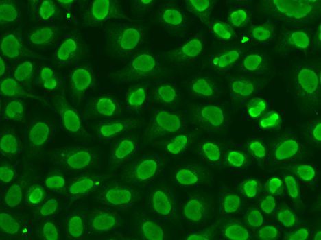 Immunofluorescence - FEN1 Polyclonal Antibody (144-01175)