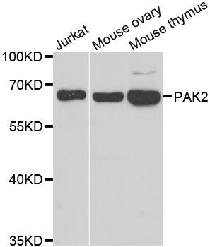Western blot - PAK2 Polyclonal Antibody (144-07333)