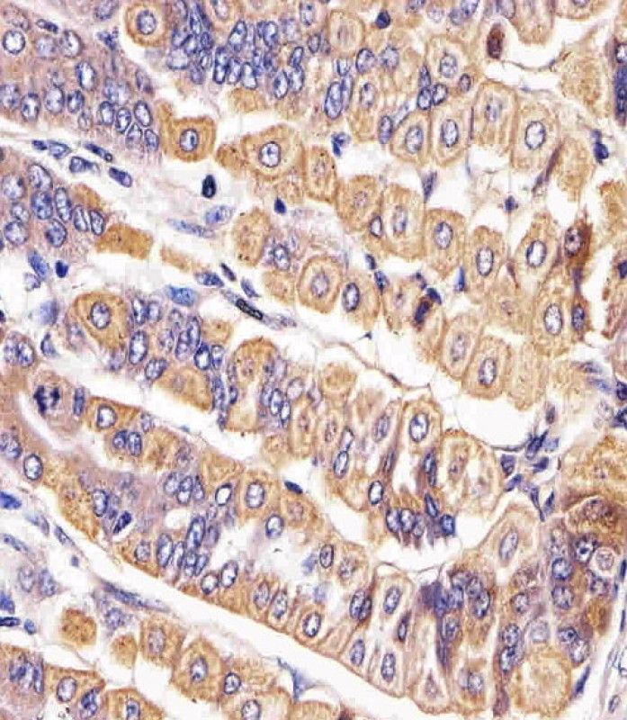 IHC-P