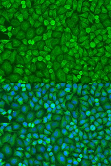 Immunofluorescence - EIF4E Polyclonal Antibody (144-02162)