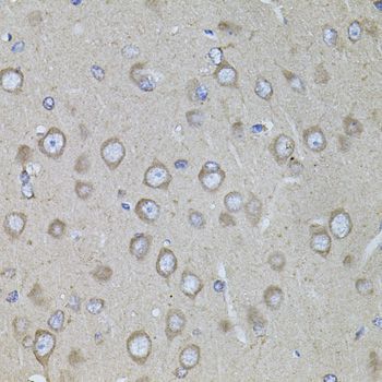 Immunohistochemistry - CRHR1 antibody (144-08409)