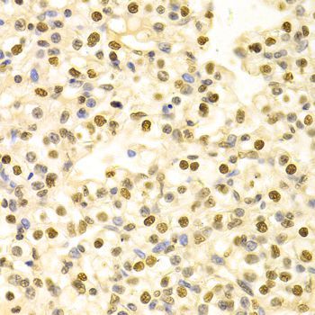 Immunohistochemistry - HDGF Antibody (144-05347)