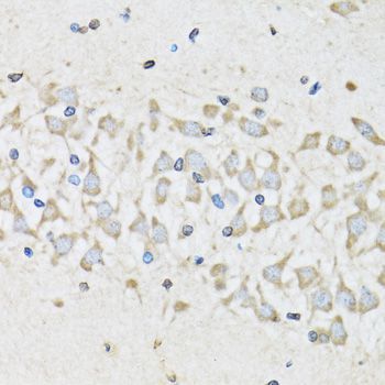 Immunohistochemistry - NUDC antibody (144-06678)