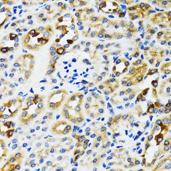 Immunohistochemistry - RPN1 antibody (144-600827)