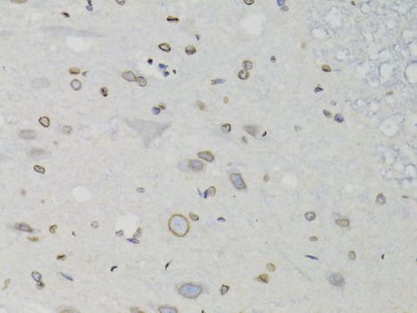 Western blot - LMNB1 Polyclonal Antibody (144-01910)