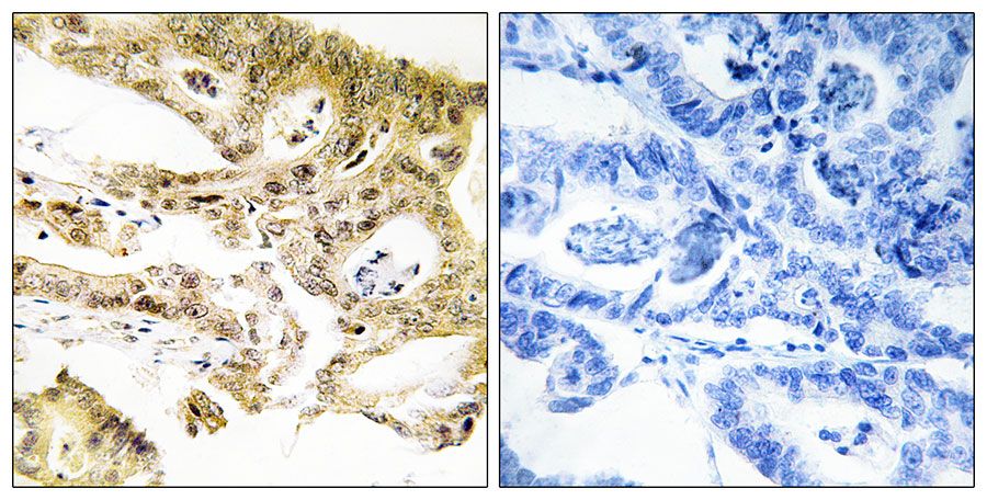 IHC