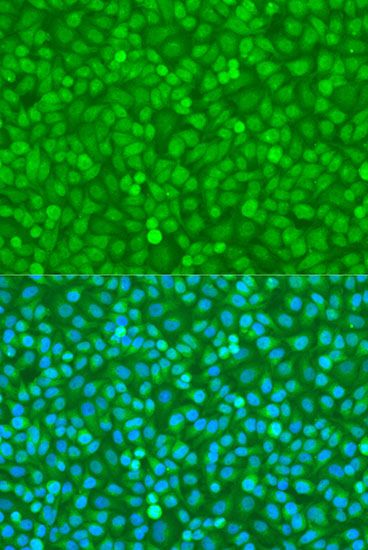 Immunofluorescence - FOXO3 Polyclonal Antibody (144-00102)