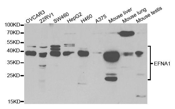Western blot - EFNA1 Polyclonal Antibody (144-05341)