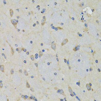 Immunohistochemistry - RAE1 antibody (144-06713)