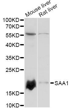 Western blot - SAA1 antibody (144-014553)