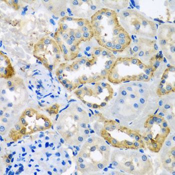 Immunohistochemistry - UQCR10 antibody (144-04674)