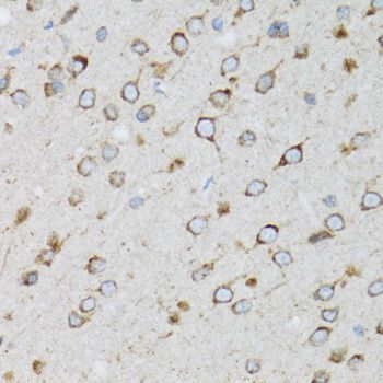 Immunohistochemistry - UBE2D1 antibody (144-01951)