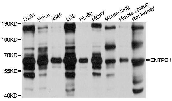 Western blot - ENTPD1 antibody (144-03778)