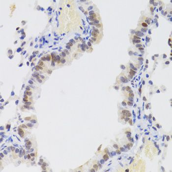 Immunohistochemistry - NASP Antibody (144-06938)