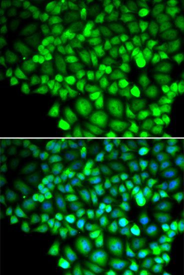Immunofluorescence - ALOX15B Polyclonal Antibody (144-06865)