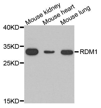 Western blot - RDM1 Polyclonal Antibody (144-06845)