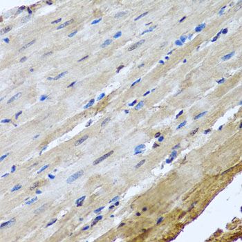 Immunohistochemistry - NUMA1 Polyclonal Antibody (144-00527)