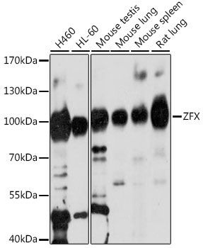 Western blot