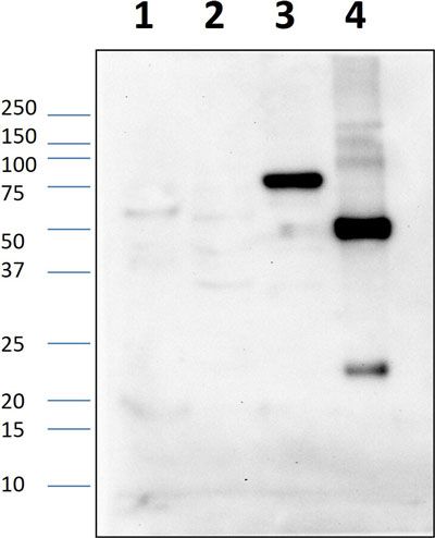 Western blot