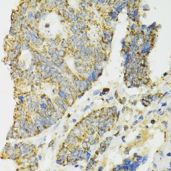 Immunohistochemistry - IDH2 Polyclonal Antibody (144-07190)