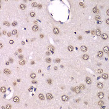 Immunohistochemistry - HNRNPM Polyclonal Antibody (144-06937)