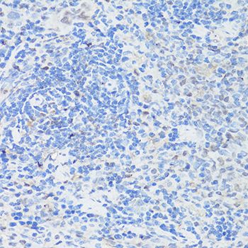 Immunohistochemistry - CASP3 Polyclonal Antibody (144-02156)
