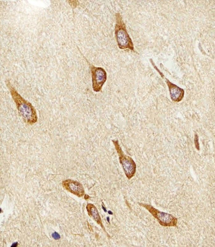 IHC-P