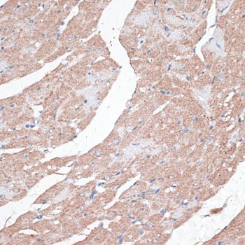 Immunohistochemistry - AHSP Polyclonal Antibody (144-06465)
