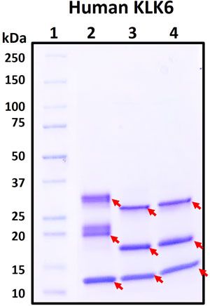 SDS-PAGE