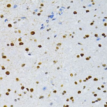 Immunohistochemistry - SNRNP70 antibody (144-06065)