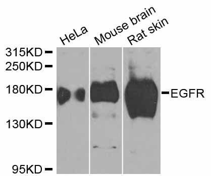 Western blot - EGFR antibody (144-02069)
