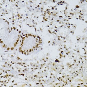 Immunohistochemistry - SNRNP70 antibody (144-06065)